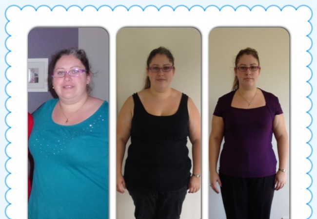 11 Weeks Out From Gastric Bypass Surgery