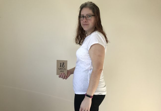 Pregnancy after bypass: Week 18 pregnancy diary