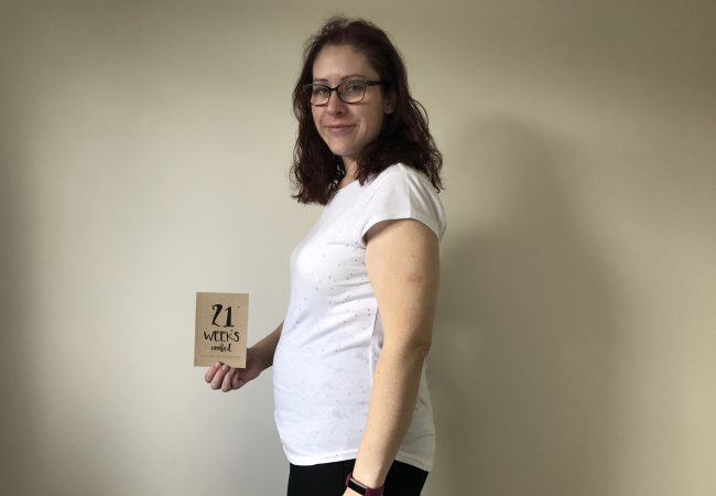 Pregnancy after bypass: Week 21 pregnancy diary